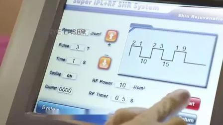 Strumento estetico Bellezza Laser IPL Rimuovi viso invecchiamento Spot YAG RF Macchina con laser